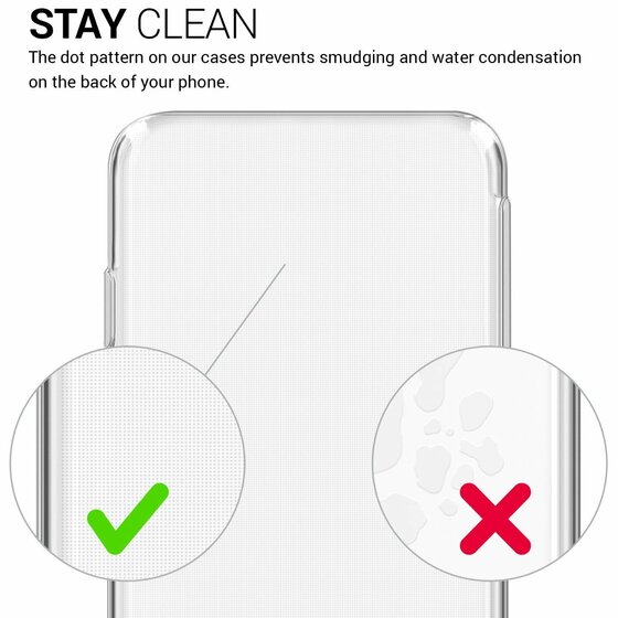 Microsonic Xiaomi Mi 5X Kılıf Transparent Soft Beyaz